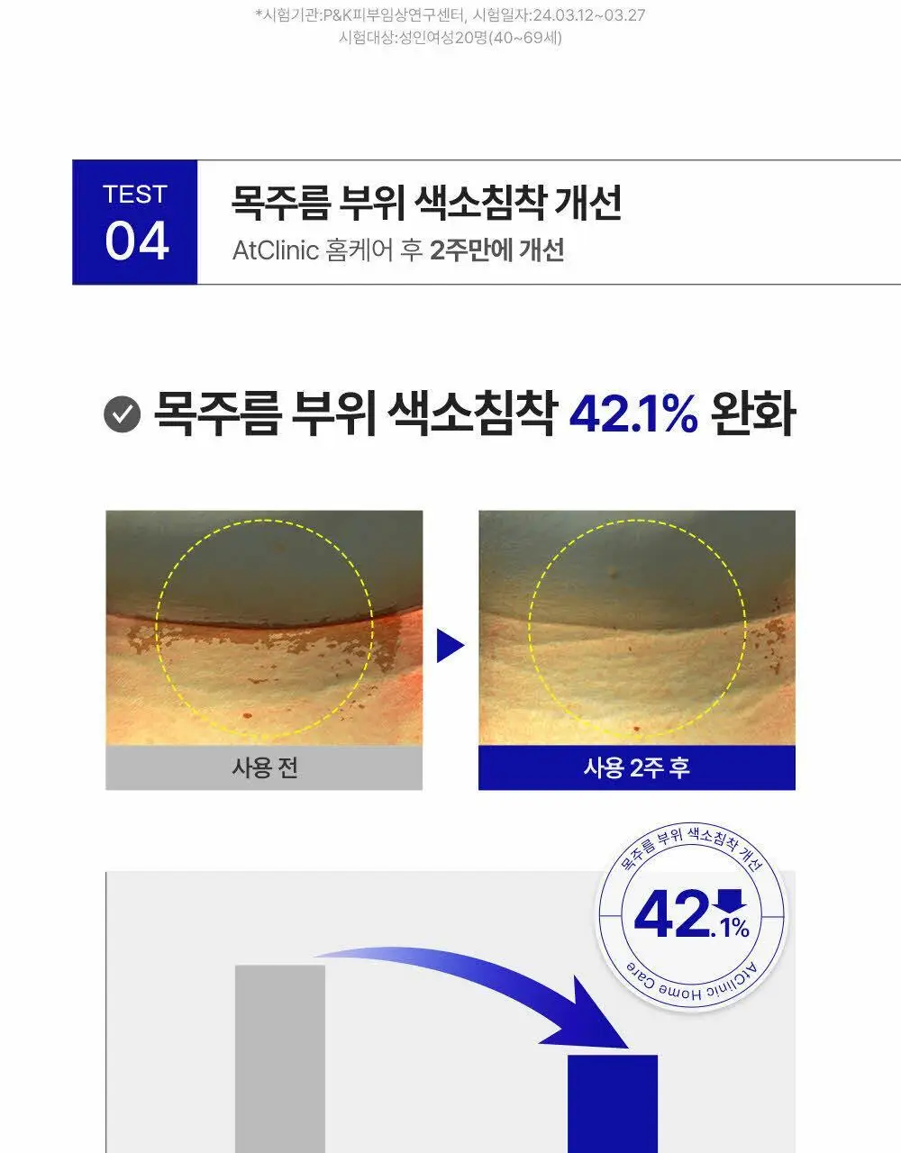 [목주름 개선] 도미나스 앳클리닉 레티놀 1600 넥 샷 목주름 세럼 30ml 상세페이지 14